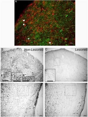 Dopamine in Auditory Nuclei and Lemniscal Projections is Poised to Influence Acoustic Integration in the Inferior Colliculus